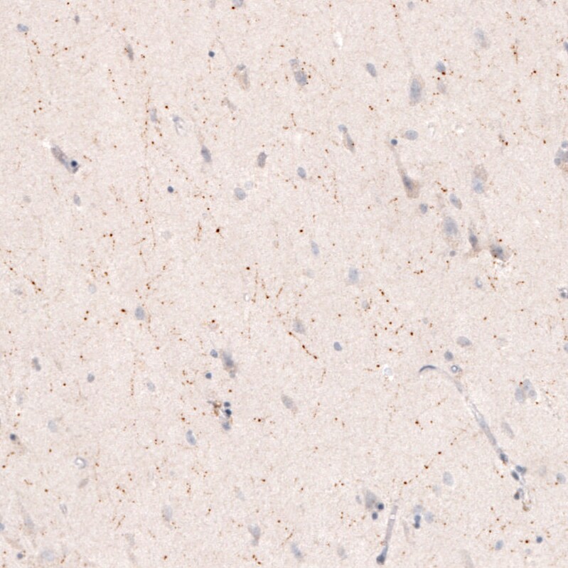 Choline Acetyltransferase/ChAT Antibody (CL3169) - Azide and BSA Free Immunohistochemistry-Paraffin: Choline Acetyltransferase/ChAT Antibody [NBP3-43798]