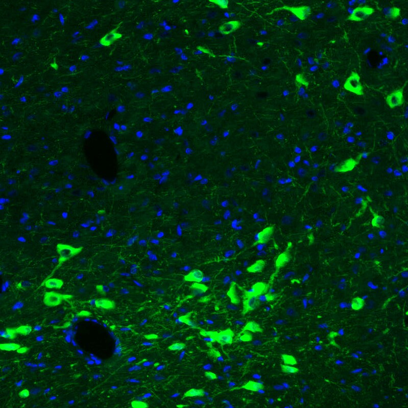 Choline Acetyltransferase/ChAT Antibody (CL3169) - Azide and BSA Free Immunohistochemistry-Paraffin: Choline Acetyltransferase/ChAT Antibody [NBP3-43798]