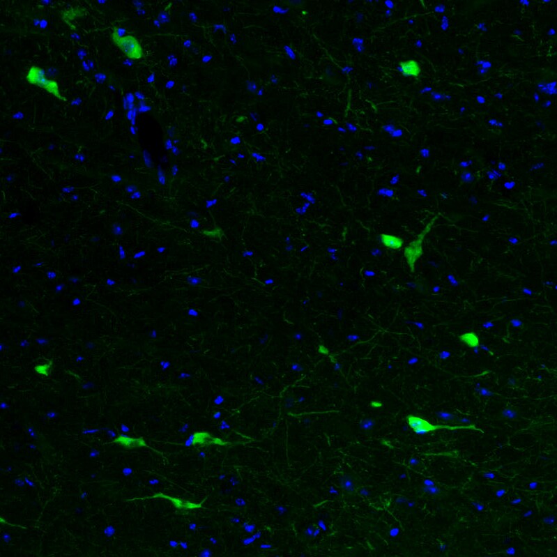 Choline Acetyltransferase/ChAT Antibody (CL3169) - Azide and BSA Free Immunohistochemistry-Paraffin: Choline Acetyltransferase/ChAT Antibody [NBP3-43798]