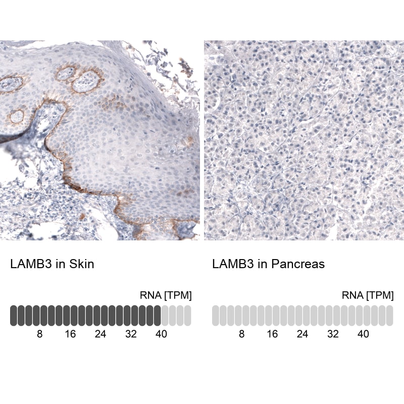 Laminin beta 3 Antibody (CL3353) - Azide and BSA Free Immunohistochemistry-Paraffin: Laminin beta 3 Antibody [NBP3-43799]