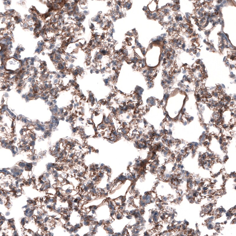 Laminin beta 3 Antibody (CL3353) - Azide and BSA Free Immunohistochemistry-Paraffin: Laminin beta 3 Antibody [NBP3-43799]