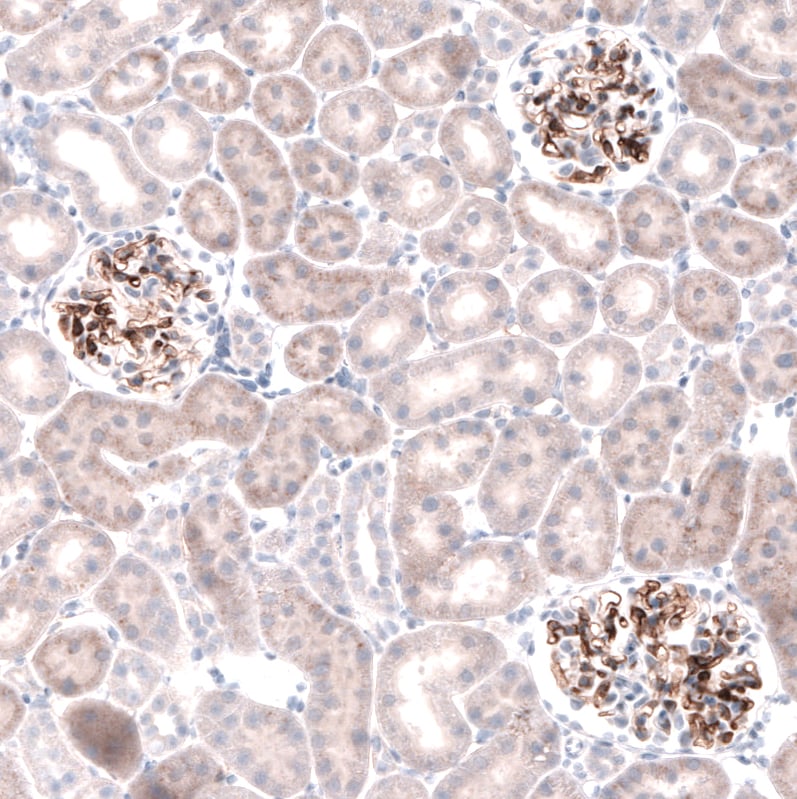 Laminin beta 3 Antibody (CL3353) - Azide and BSA Free Immunohistochemistry-Paraffin: Laminin beta 3 Antibody [NBP3-43799]