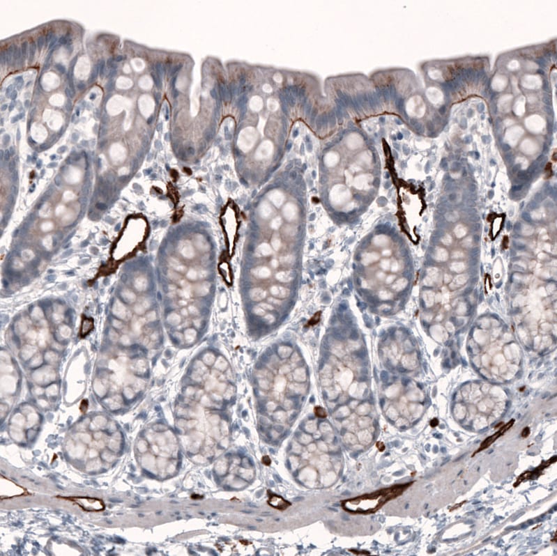 Laminin beta 3 Antibody (CL3353) - Azide and BSA Free Immunohistochemistry-Paraffin: Laminin beta 3 Antibody [NBP3-43799]
