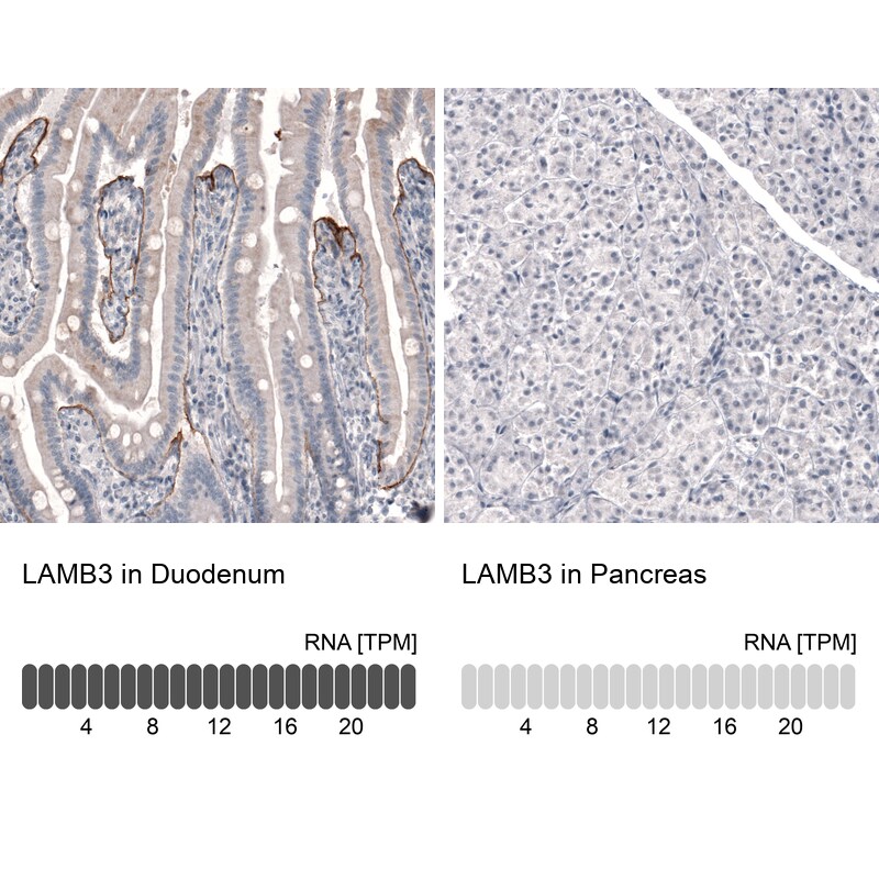 Laminin beta 3 Antibody (CL3363) - Azide and BSA Free Immunohistochemistry-Paraffin: Laminin beta 3 Antibody [NBP3-43800]