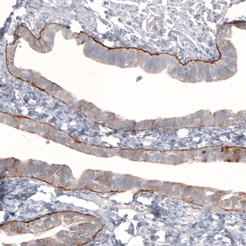 Laminin beta 3 Antibody (CL3363) - Azide and BSA Free Immunohistochemistry-Paraffin: Laminin beta 3 Antibody [NBP3-43800]
