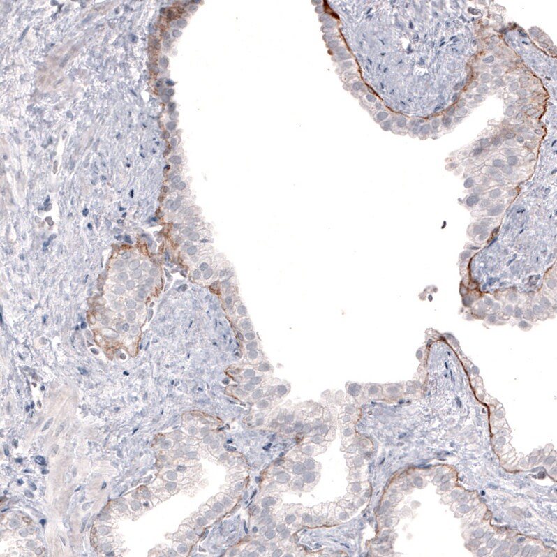 Laminin beta 3 Antibody (CL3363) - Azide and BSA Free Immunohistochemistry-Paraffin: Laminin beta 3 Antibody [NBP3-43800]