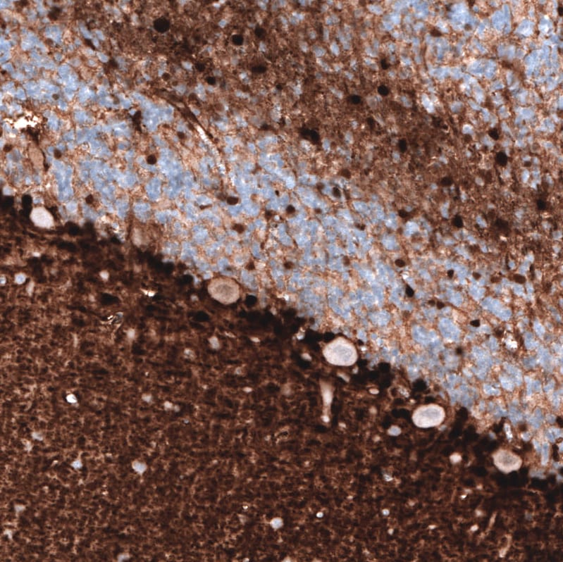 S100B Antibody (CL2720) - Azide and BSA Free Immunohistochemistry-Paraffin: S100B Antibody [NBP3-43801]