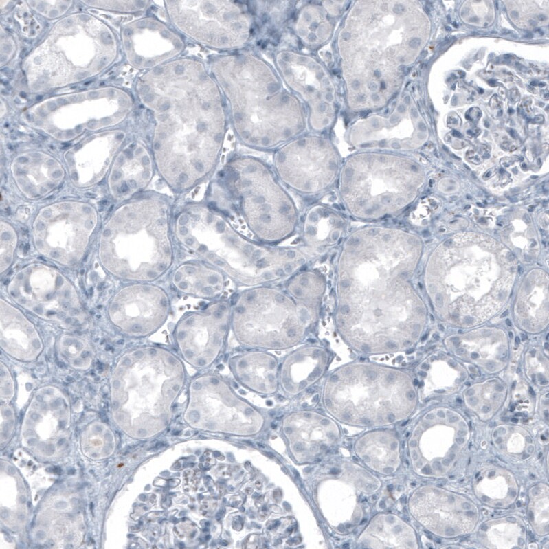 S100B Antibody (CL2720) - Azide and BSA Free Immunohistochemistry-Paraffin: S100B Antibody [NBP3-43801]