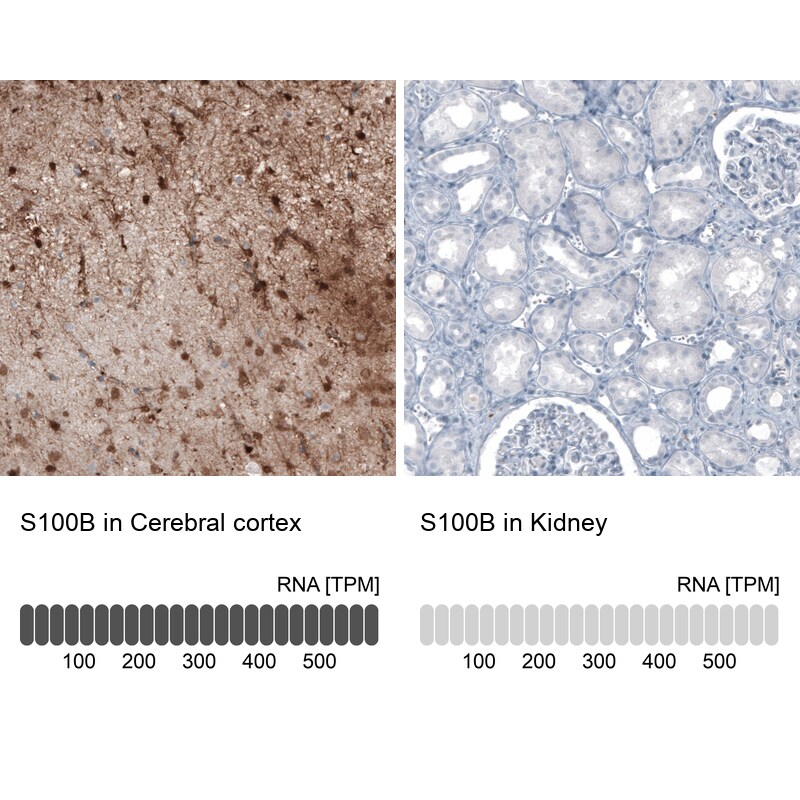 S100B Antibody (CL2720) - Azide and BSA Free Immunohistochemistry-Paraffin: S100B Antibody [NBP3-43801]
