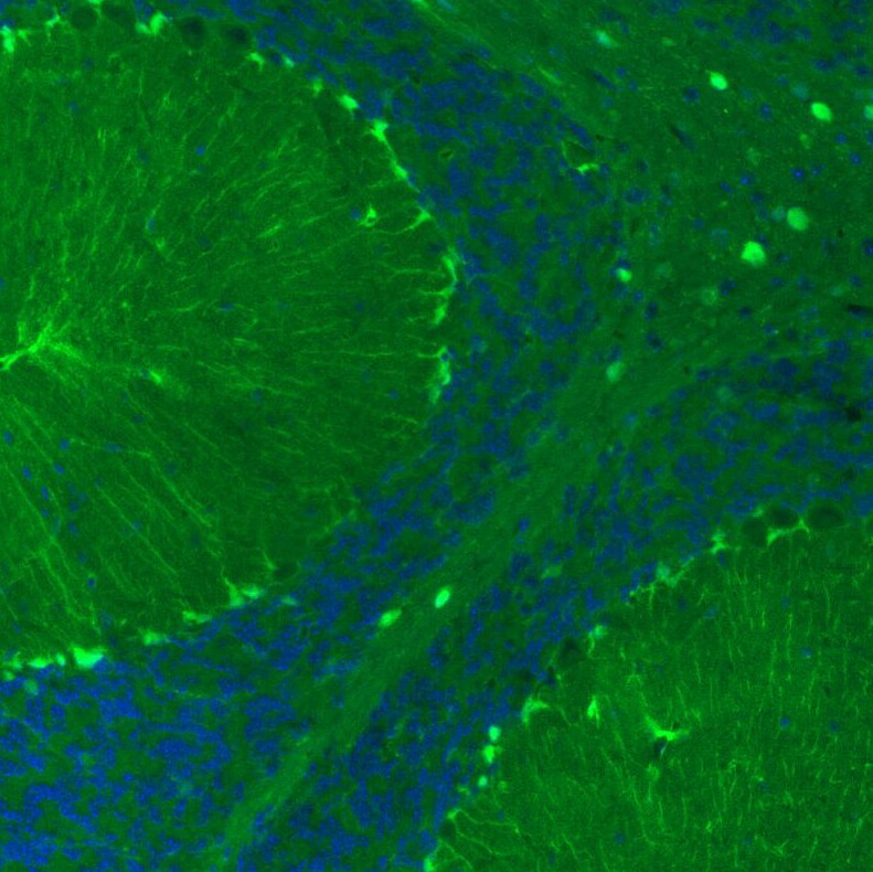 S100B Antibody (CL2720) - Azide and BSA Free Immunohistochemistry-Paraffin: S100B Antibody [NBP3-43801]