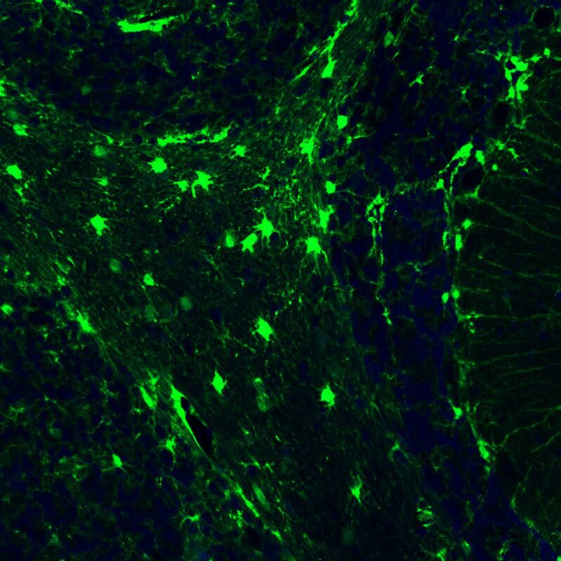 S100B Antibody (CL2720) - Azide and BSA Free Immunohistochemistry-Paraffin: S100B Antibody [NBP3-43801]