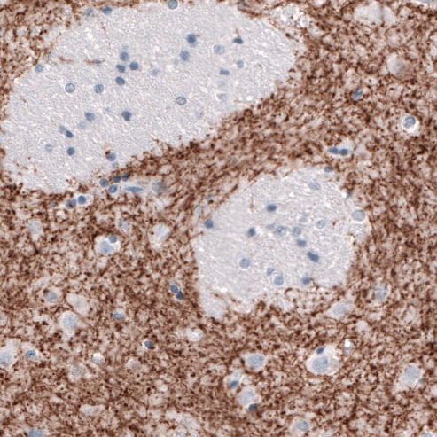 SLC6A3/DAT1 Antibody (CL3123) - Azide and BSA Free Immunohistochemistry-Paraffin: SLC6A3/DAT1 Antibody [NBP3-43803]