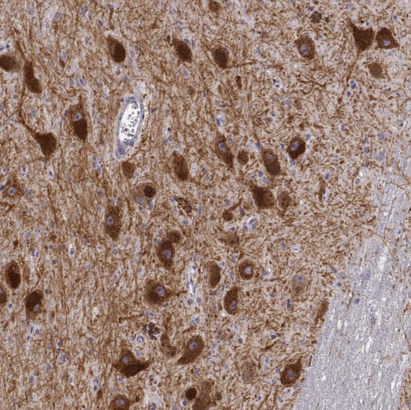 SLC6A3/DAT1 Antibody (CL3123) - Azide and BSA Free Immunohistochemistry-Paraffin: SLC6A3/DAT1 Antibody [NBP3-43803]