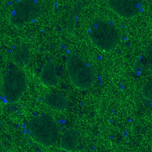 SLC6A3/DAT1 Antibody (CL3123) - Azide and BSA Free Immunohistochemistry-Paraffin: SLC6A3/DAT1 Antibody [NBP3-43803]