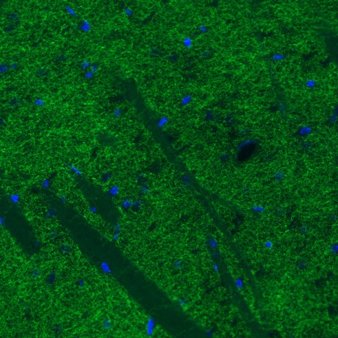 SLC6A3/DAT1 Antibody (CL3123) - Azide and BSA Free Immunohistochemistry-Paraffin: SLC6A3/DAT1 Antibody [NBP3-43803]