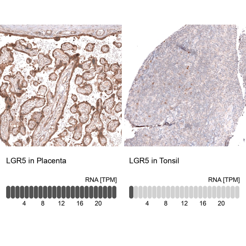 Lgr5/GPR49 Antibody (CL13579) - Azide and BSA Free Immunohistochemistry-Paraffin: Lgr5/GPR49 Antibody [NBP3-43804]