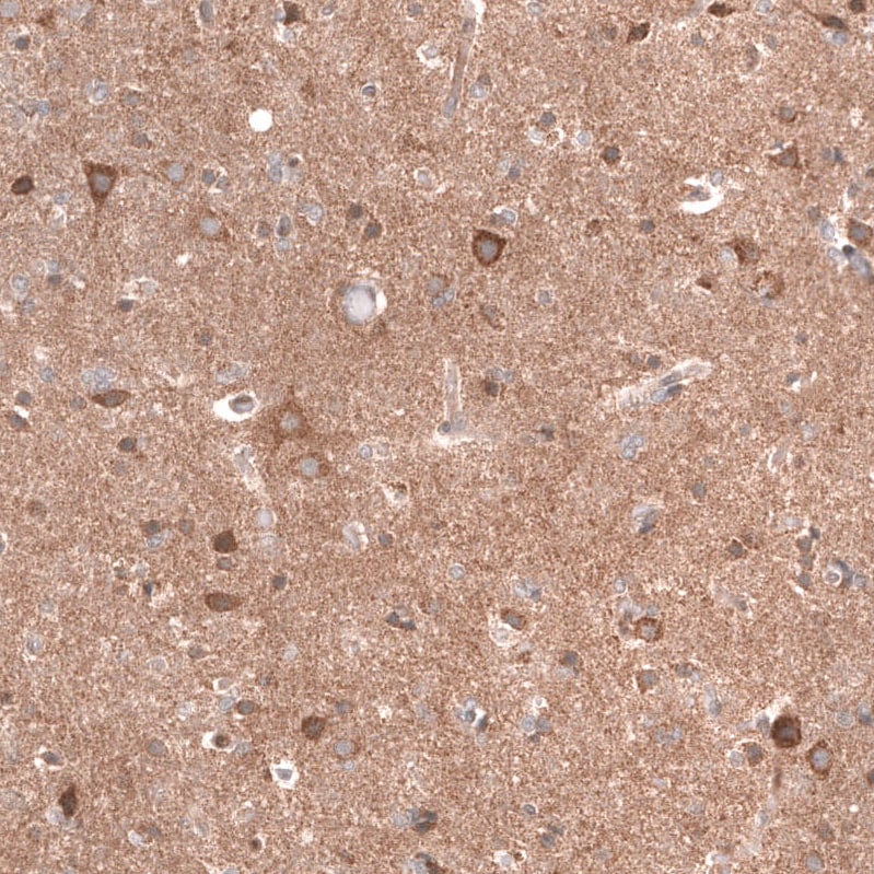 Lgr5/GPR49 Antibody (CL13579) - Azide and BSA Free Immunohistochemistry-Paraffin: Lgr5/GPR49 Antibody [NBP3-43804]