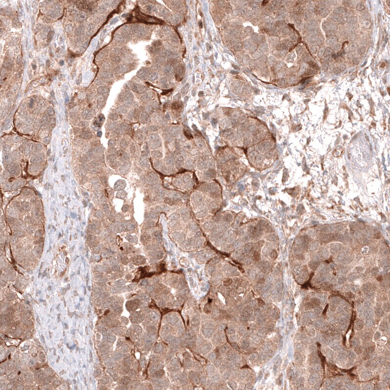 Lgr5/GPR49 Antibody (CL13579) - Azide and BSA Free Immunohistochemistry-Paraffin: Lgr5/GPR49 Antibody [NBP3-43804]