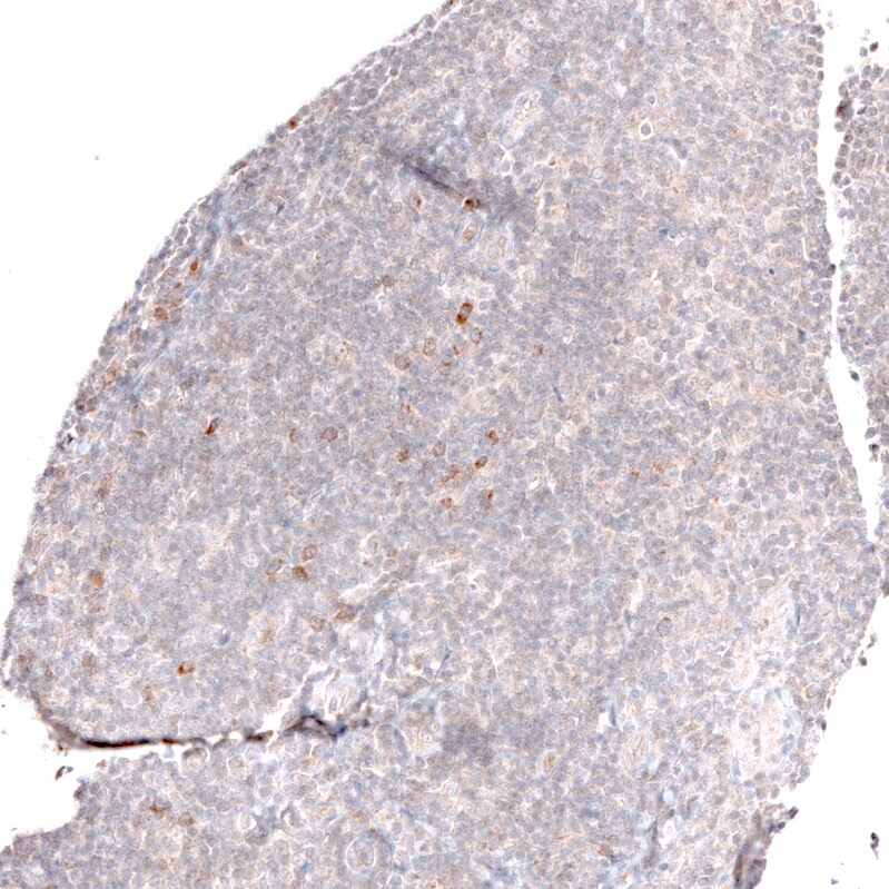 Lgr5/GPR49 Antibody (CL13579) - Azide and BSA Free Immunohistochemistry-Paraffin: Lgr5/GPR49 Antibody [NBP3-43804]