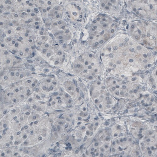 Glutamine Synthetase Antibody (CL2999) - Azide and BSA Free Immunohistochemistry-Paraffin: Glutamine Synthetase Antibody [NBP3-43805]