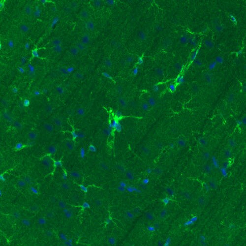 Glutamine Synthetase Antibody (CL2999) - Azide and BSA Free Immunohistochemistry-Paraffin: Glutamine Synthetase Antibody [NBP3-43805]