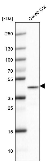 Glutamine Synthetase Antibody (CL2999) - Azide and BSA Free Western Blot: Glutamine Synthetase Antibody [NBP3-43805]