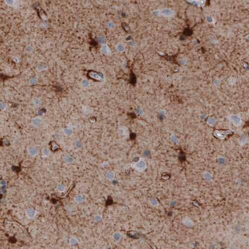 Glutamine Synthetase Antibody (CL3004) - Azide and BSA Free Immunohistochemistry-Paraffin: Glutamine Synthetase Antibody [NBP3-43806]