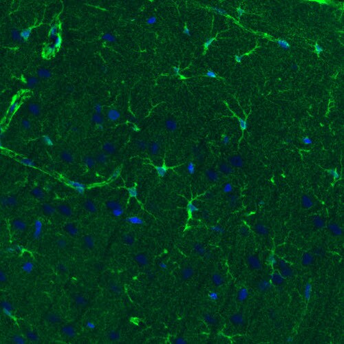 Glutamine Synthetase Antibody (CL3004) - Azide and BSA Free Immunohistochemistry-Paraffin: Glutamine Synthetase Antibody [NBP3-43806]