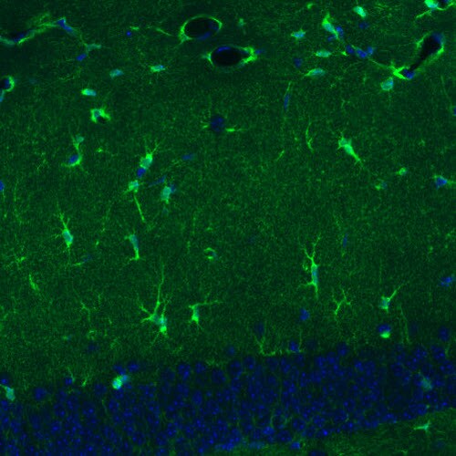 Glutamine Synthetase Antibody (CL3004) - Azide and BSA Free Immunohistochemistry-Paraffin: Glutamine Synthetase Antibody [NBP3-43806]
