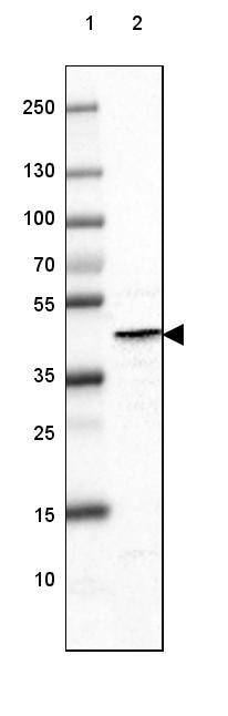 Glutamine Synthetase Antibody (CL3013) - Azide and BSA Free Western Blot: Glutamine Synthetase Antibody [NBP3-43807]