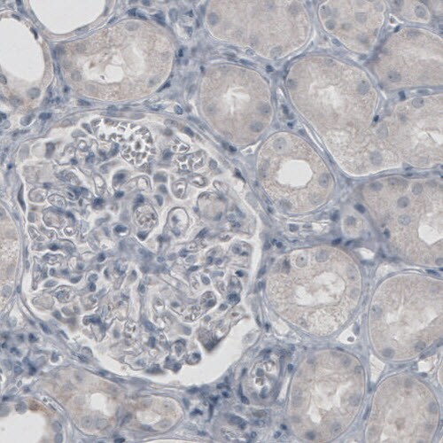 Glutamine Synthetase Antibody (CL3013) - Azide and BSA Free Immunohistochemistry-Paraffin: Glutamine Synthetase Antibody [NBP3-43807]