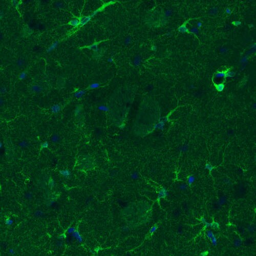 Glutamine Synthetase Antibody (CL3013) - Azide and BSA Free Immunohistochemistry-Paraffin: Glutamine Synthetase Antibody [NBP3-43807]