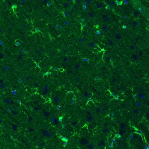 Glutamine Synthetase Antibody (CL3013) - Azide and BSA Free Immunohistochemistry-Paraffin: Glutamine Synthetase Antibody [NBP3-43807]