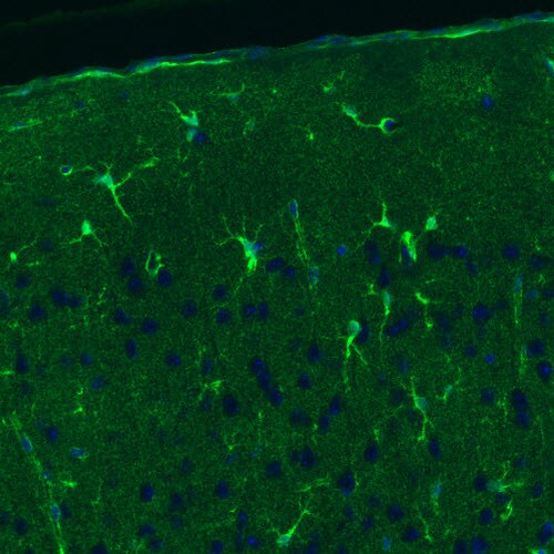 Glutamine Synthetase Antibody (CL3013) - Azide and BSA Free Immunohistochemistry-Paraffin: Glutamine Synthetase Antibody [NBP3-43807]