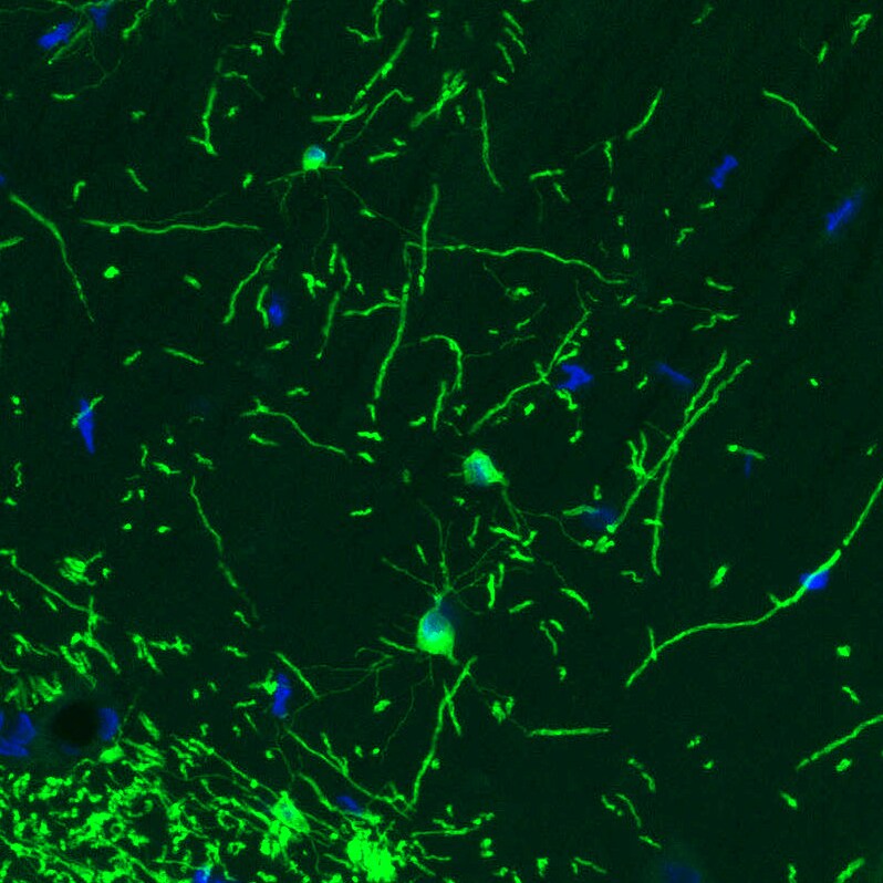 CNPase Antibody (CL2887) - Azide and BSA Free Immunohistochemistry-Paraffin: CNPase Antibody [NBP3-43808]