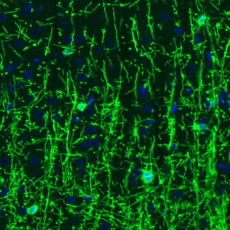 CNPase Antibody (CL2887) - Azide and BSA Free Immunohistochemistry-Paraffin: CNPase Antibody [NBP3-43808]