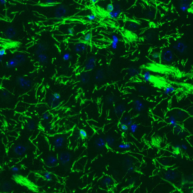 CNPase Antibody (CL2887) - Azide and BSA Free Immunohistochemistry-Paraffin: CNPase Antibody [NBP3-43808]