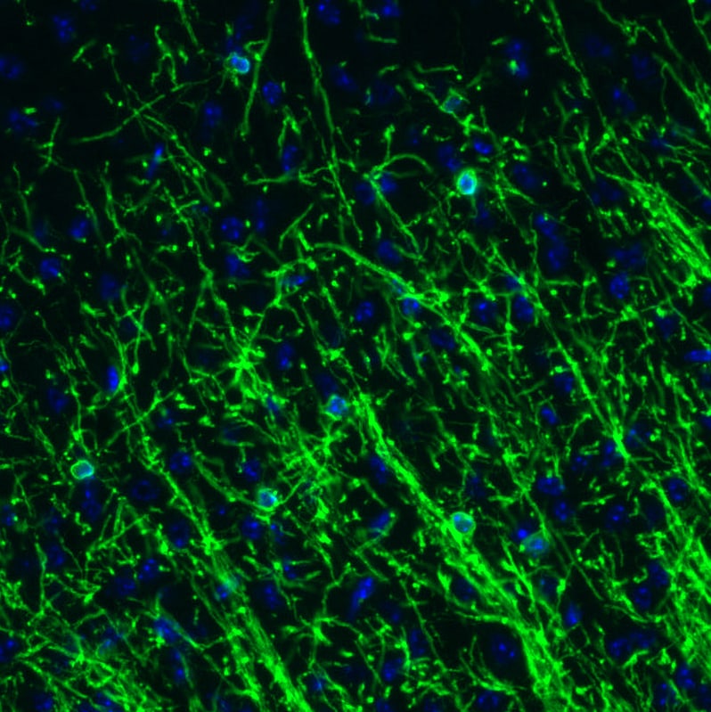 CNPase Antibody (CL2887) - Azide and BSA Free Immunohistochemistry-Paraffin: CNPase Antibody [NBP3-43808]