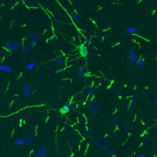 CNPase Antibody (CL2887) - Azide and BSA Free Immunohistochemistry-Paraffin: CNPase Antibody [NBP3-43808]