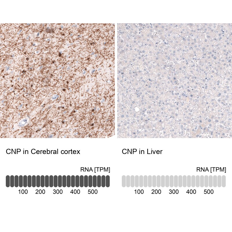 CNPase Antibody (CL2871) - Azide and BSA Free Immunohistochemistry-Paraffin: CNPase Antibody [NBP3-43809]