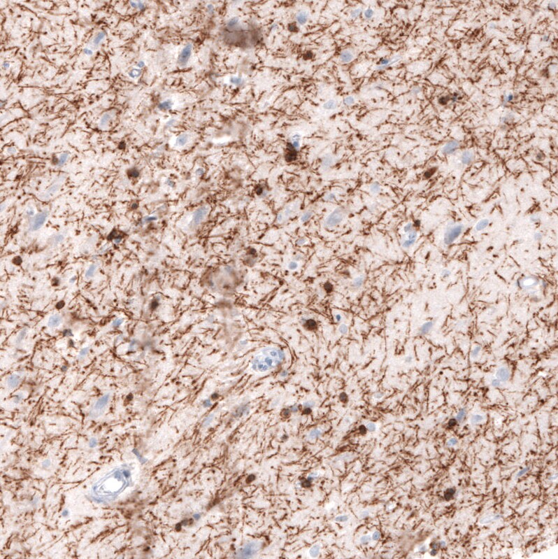 CNPase Antibody (CL2871) - Azide and BSA Free Immunohistochemistry-Paraffin: CNPase Antibody [NBP3-43809]