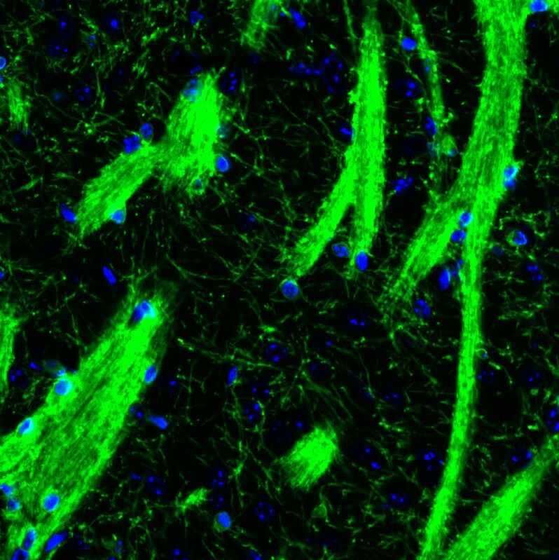 CNPase Antibody (CL2871) - Azide and BSA Free Immunohistochemistry-Paraffin: CNPase Antibody [NBP3-43809]