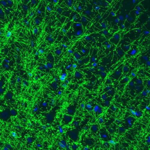 CNPase Antibody (CL2871) - Azide and BSA Free Immunohistochemistry-Paraffin: CNPase Antibody [NBP3-43809]