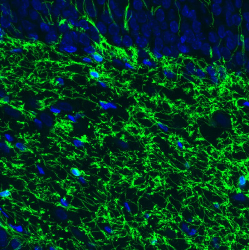 CNPase Antibody (CL2871) - Azide and BSA Free Immunohistochemistry-Paraffin: CNPase Antibody [NBP3-43809]