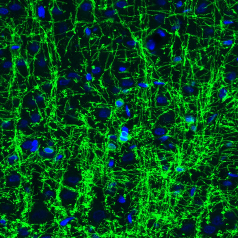 CNPase Antibody (CL2871) - Azide and BSA Free Immunohistochemistry-Paraffin: CNPase Antibody [NBP3-43809]