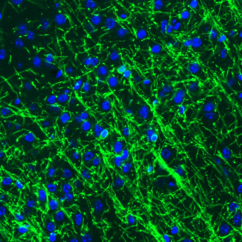 CNPase Antibody (CL2871) - Azide and BSA Free Immunohistochemistry-Paraffin: CNPase Antibody [NBP3-43809]