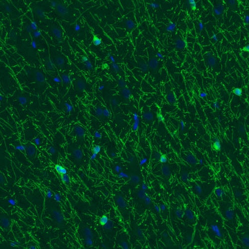 CNPase Antibody (CL2872) - Azide and BSA Free Immunohistochemistry-Paraffin: CNPase Antibody [NBP3-43810]
