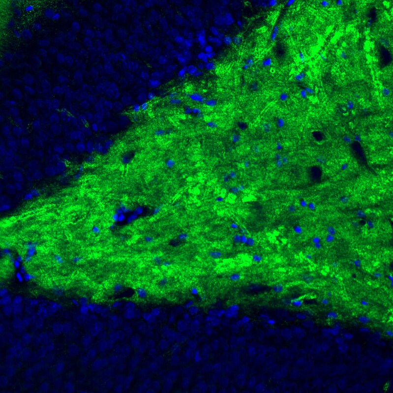 VGLUT1 Antibody (CL2754) - Azide and BSA Free Immunohistochemistry-Paraffin: VGLUT1 Antibody [NBP3-43811]