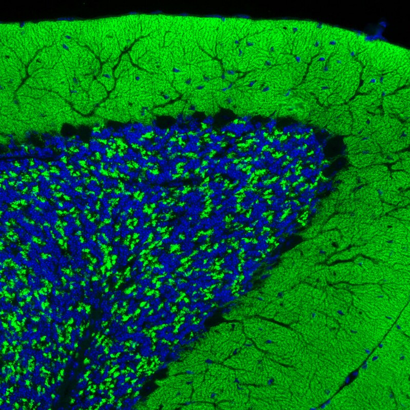 VGLUT1 Antibody (CL2754) - Azide and BSA Free Immunohistochemistry-Paraffin: VGLUT1 Antibody [NBP3-43811]