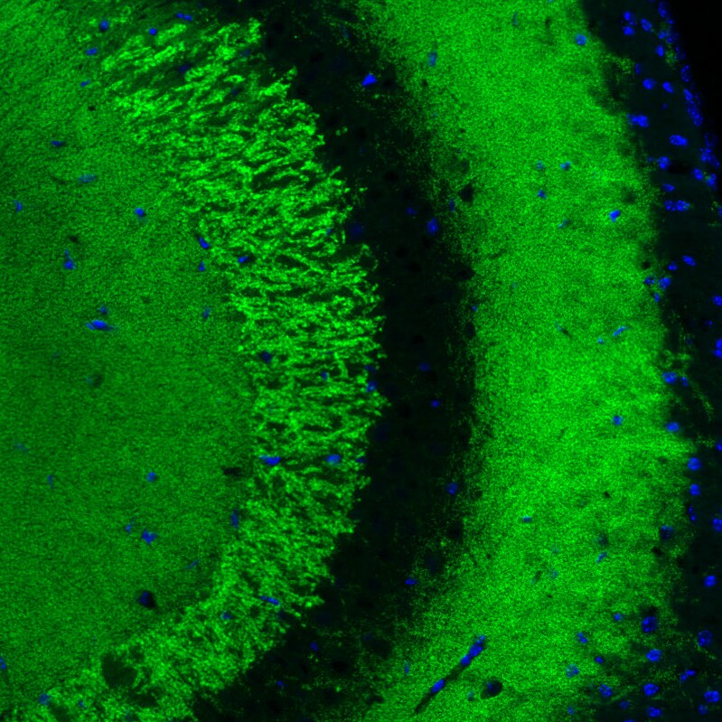 VGLUT1 Antibody (CL2754) - Azide and BSA Free Immunohistochemistry-Paraffin: VGLUT1 Antibody [NBP3-43811]